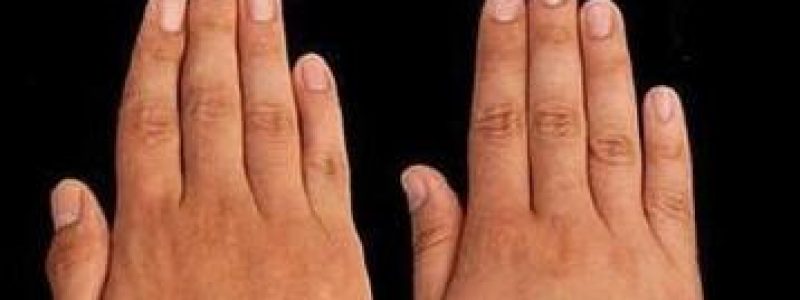longitud de los dedos y fertilidad